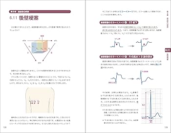 レジデントのための これだけ心電図 | 佐藤 弘明 |本 | 通販